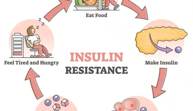 Insulin resistance pathological health condition educational outline diagram